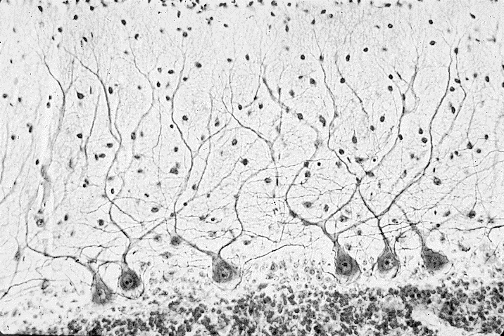 Задание №64910: Какой тип ткани изображён на микрофотографии ...